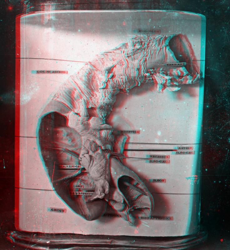 XXX